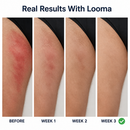 Looma - Antifungal Barrier Cream