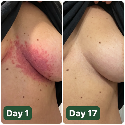 Looma Antifungal Barrier Cream