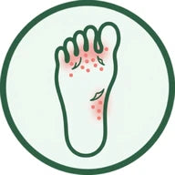 Foot with fungus between the toes