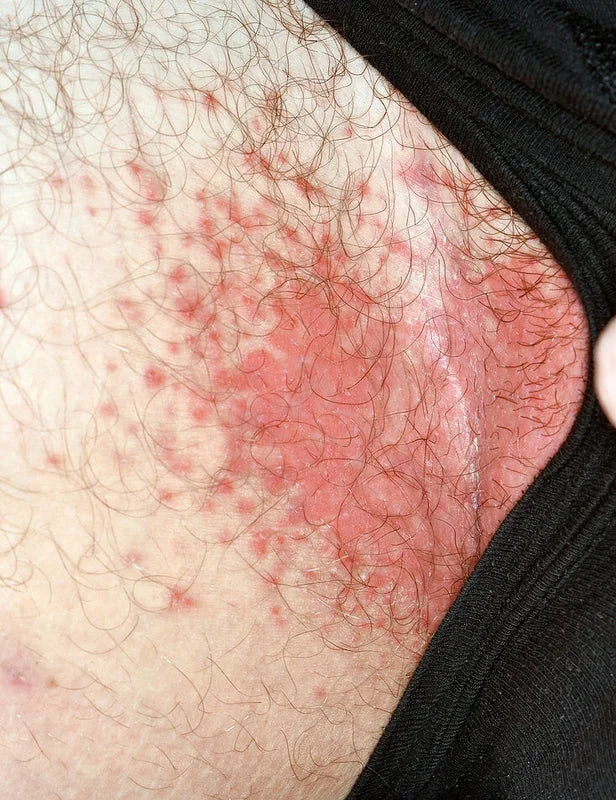 Before using Looma