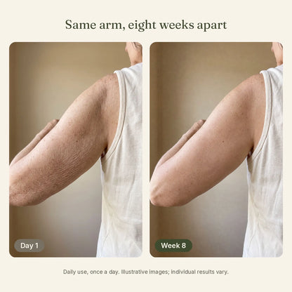 Crepey upper arm on day 1 and after 8 weeks of daily use