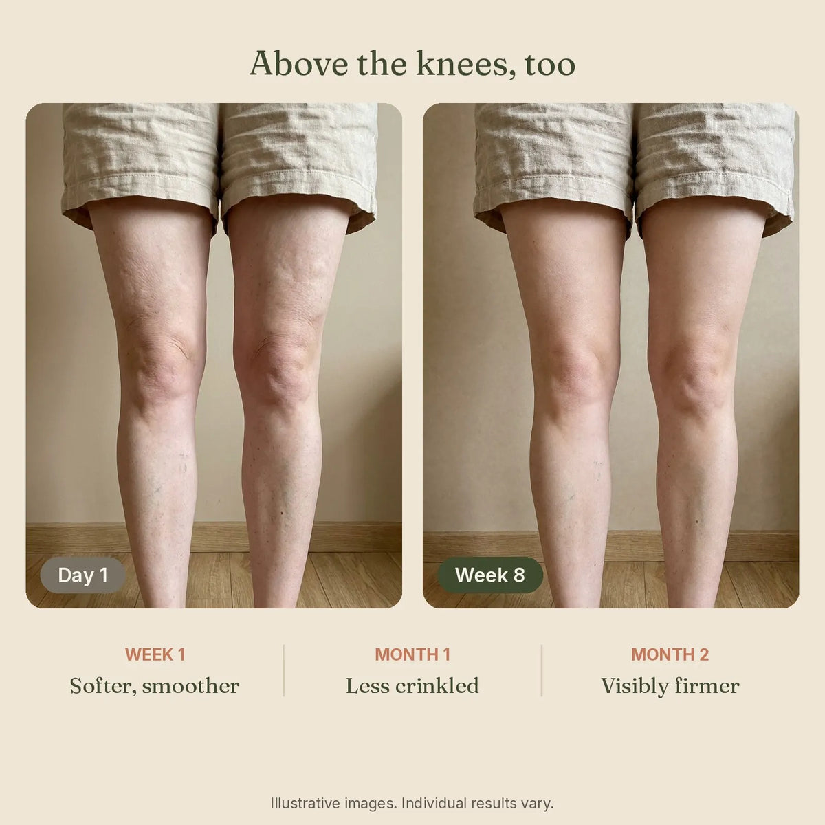 Skin above the knees on day 1 and after 8 weeks