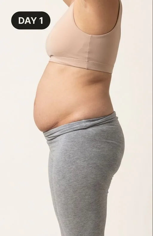 Day 1: side view of a postpartum belly