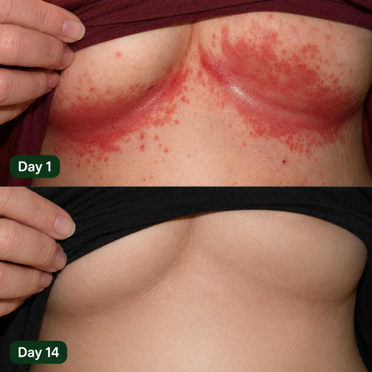 Looma Antifungal Barrier Cream