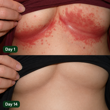 Looma Antifungal Barrier Cream