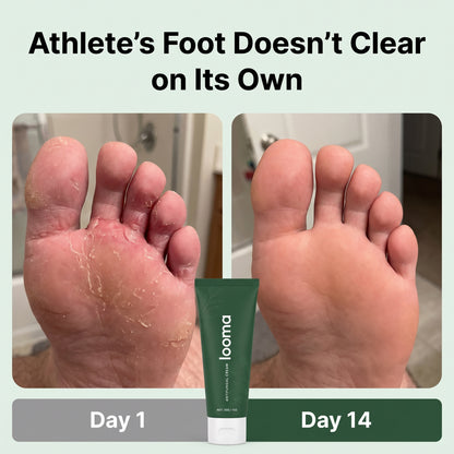Looma Antifungal Barrier Cream