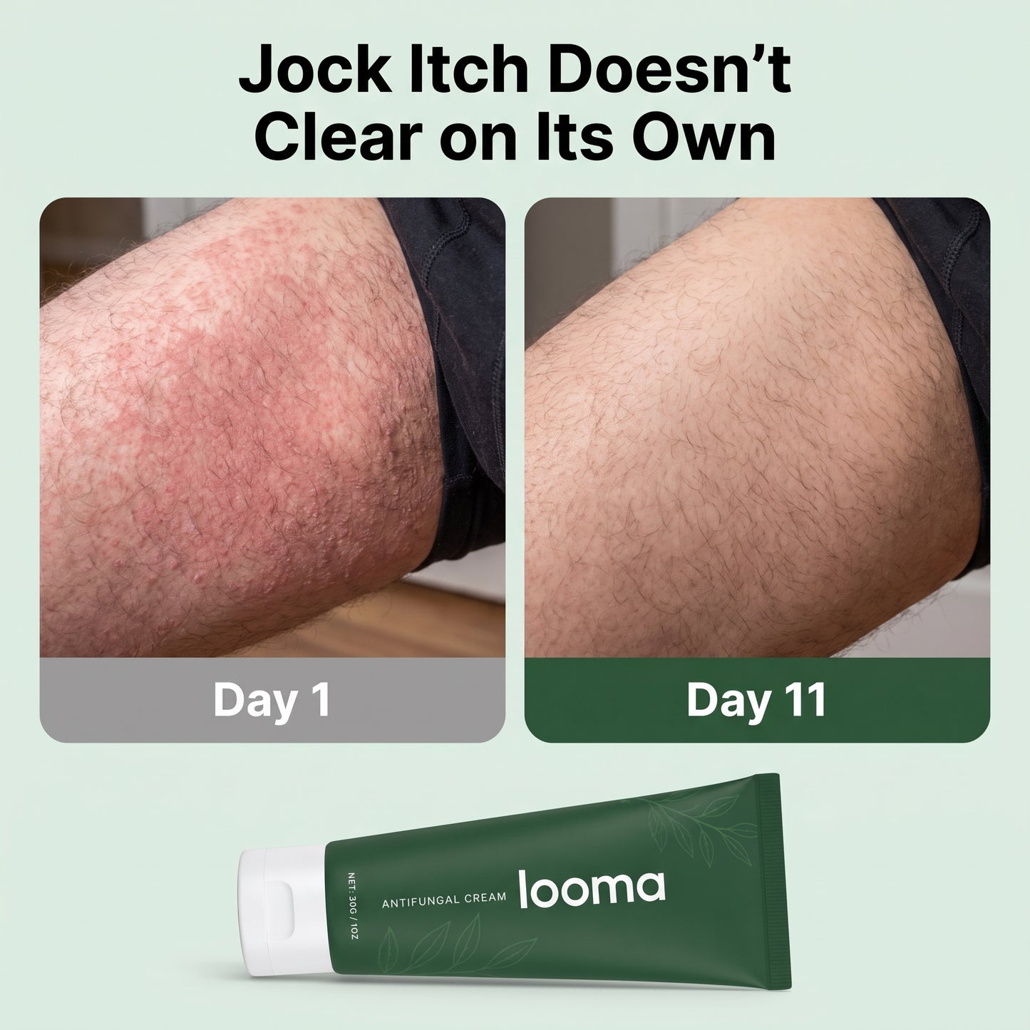Looma Antifungal Barrier Cream