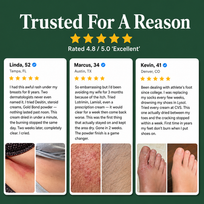 Looma Antifungal Barrier Cream